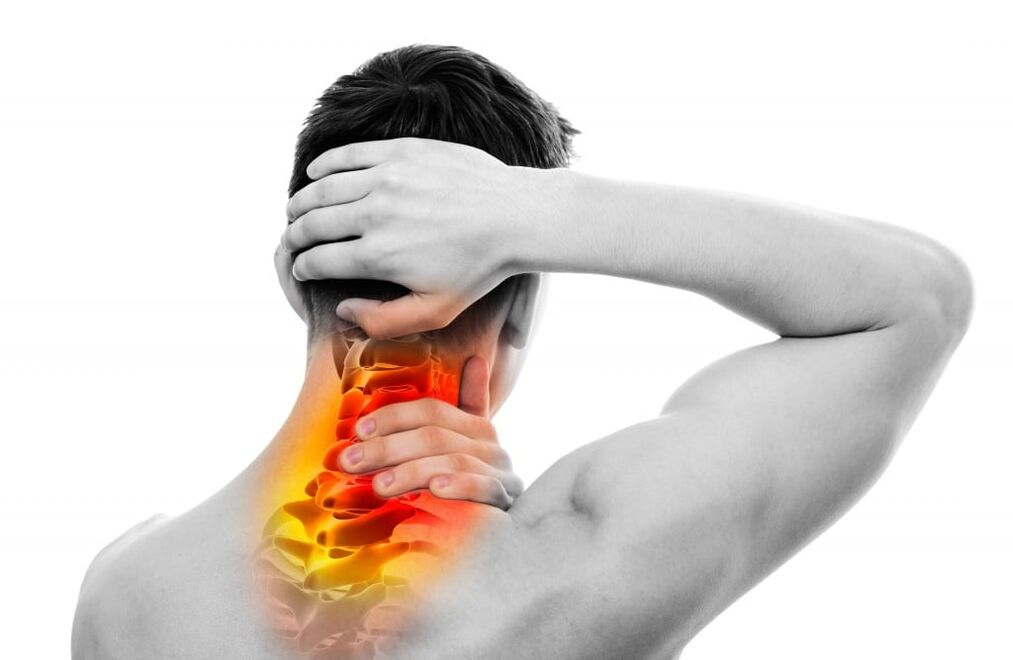 síntomas de osteocondrosis cervical